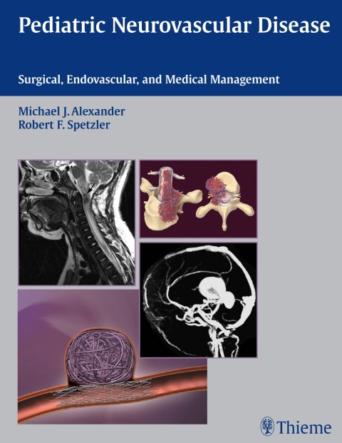 Cover image for book Pediatric Neurovascular Disease