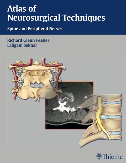 Cover image for book Atlas of Neurosurgical Techniques