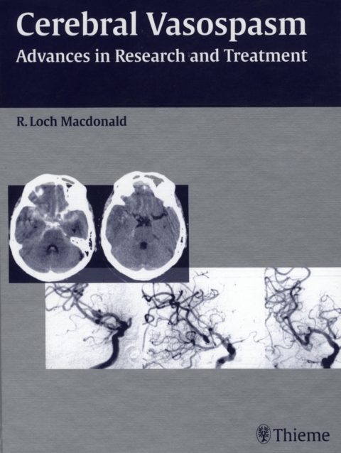 Cover image for book Cerebral Vasospasm