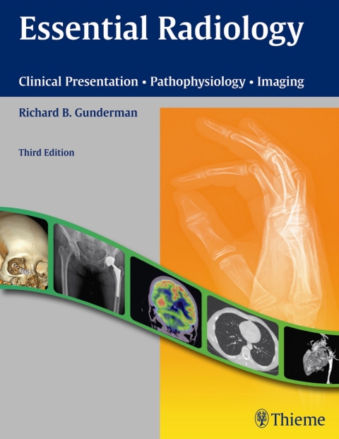 Cover image for book Essential Radiology