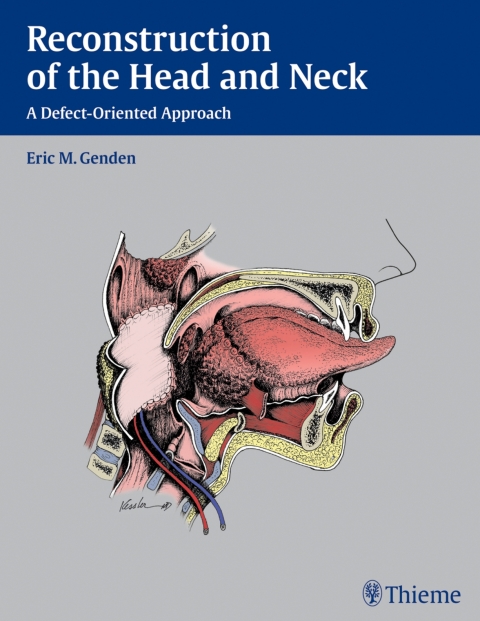 Cover image for book Reconstruction of the Head and Neck