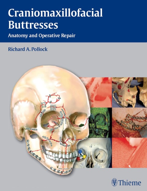 Cover image for book Craniomaxillofacial Buttresses