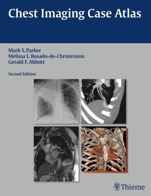 Cover image for book Chest Imaging Case Atlas