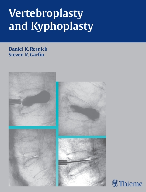 Cover image for book Vertebroplasty and Kyphoplasty