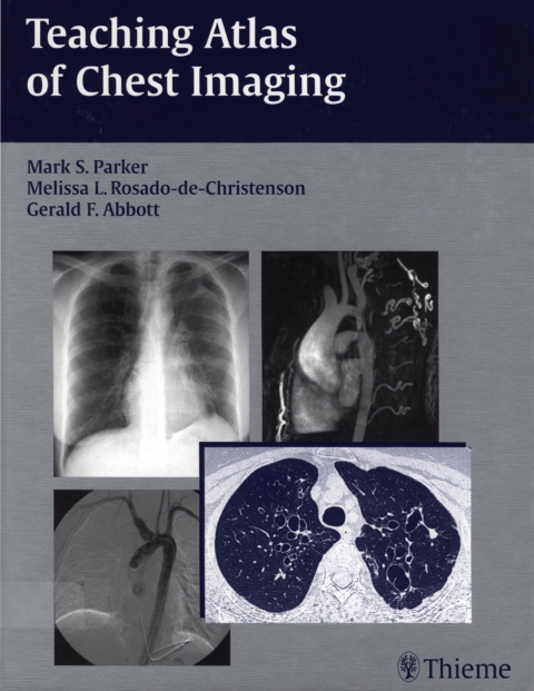 Cover image for book Teaching Atlas of Chest Imaging