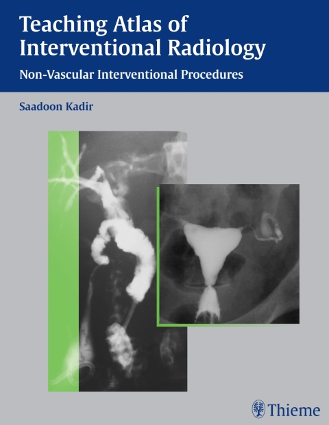Cover image for book Teaching Atlas of Interventional Radiology