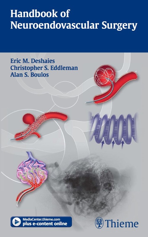 Cover image for book Handbook of Neuroendovascular Surgery