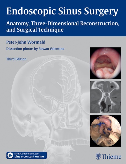Cover image for book Endoscopic Sinus Surgery: Anatomy, Three-Dimensional Reconstruction, and Surgical Technique