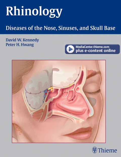 Rhinology Diseases of the Nose, Sinuses, and Skull Base