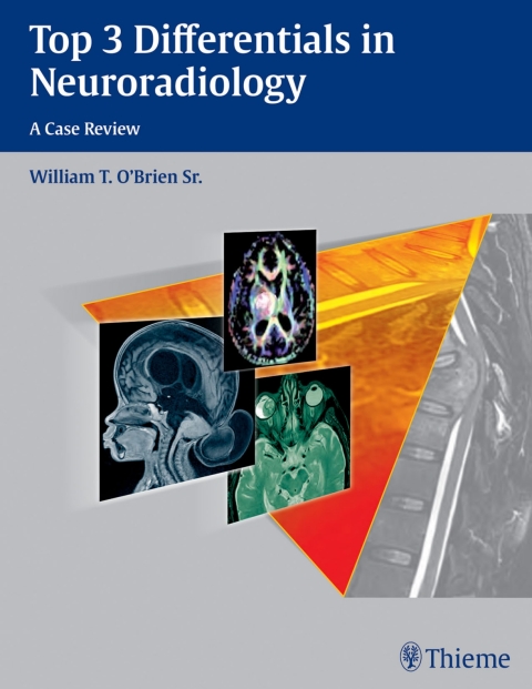Cover image for book Top 3 Differentials in Neuroradiology