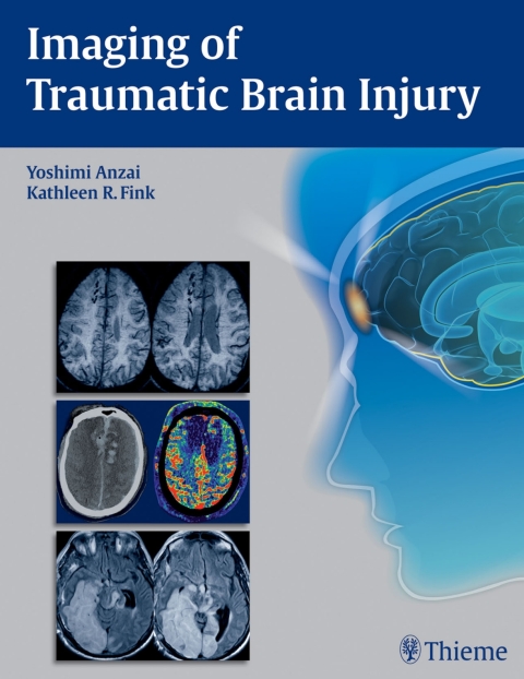 Cover image for book Imaging of Traumatic Brain Injury