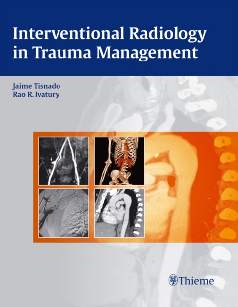 Cover image for book Interventional Radiology in Trauma Management