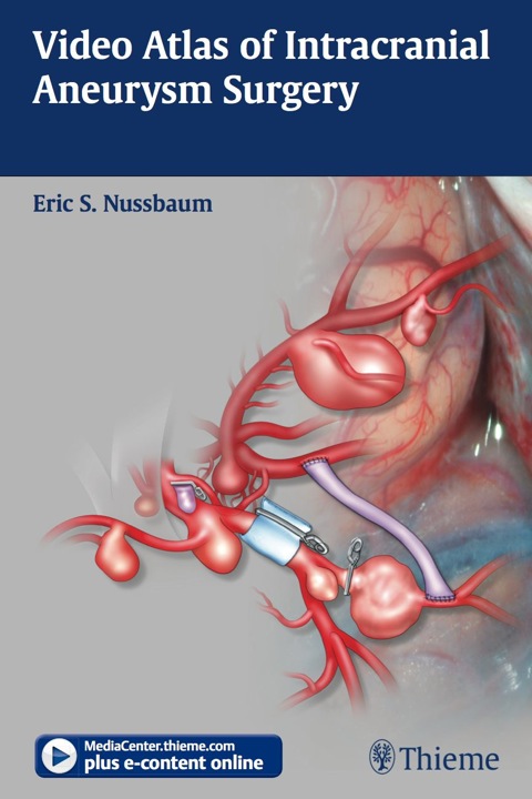 Cover image for book Video Atlas of Intracranial Aneurysm Surgery