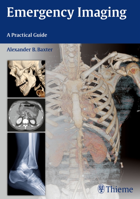 Cover image for book Emergency Imaging