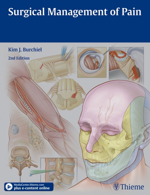 Surgical Management of Pain