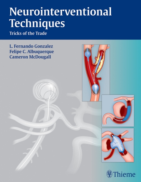 Cover image for book Neurointerventional Techniques