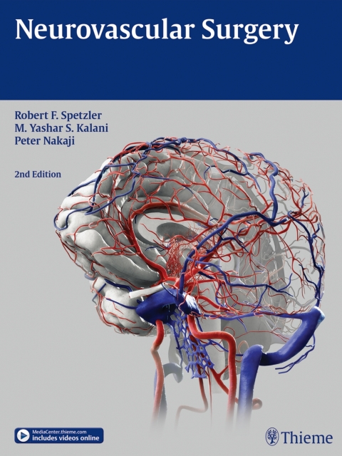 Neurovascular Surgery 