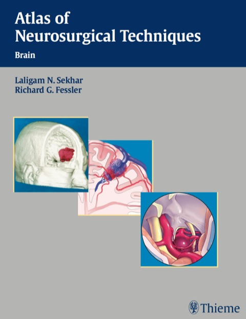Cover image for book Atlas of Neurosurgical Techniques