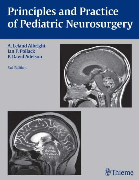 Principles and Practice of Pediatric Neurosurgery 