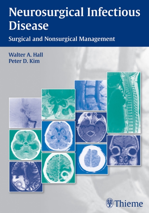 Neurosurgical Infectious Disease 