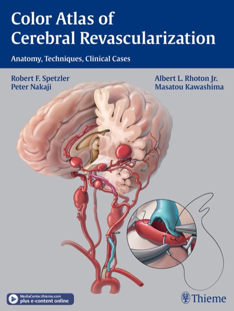 Color Atlas of Cerebral Revascularization 