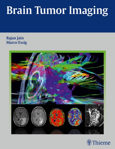 Cover image for book Brain Tumor Imaging