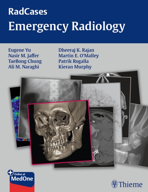 Radcases Emergency Radiology 