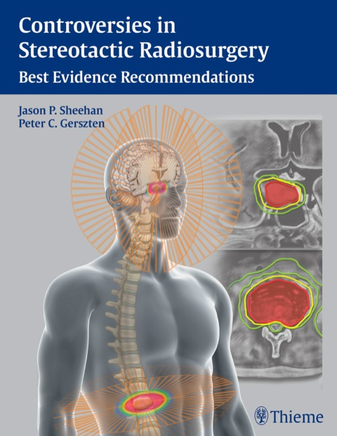 Controversies in Stereotactic  Radiosurgery 