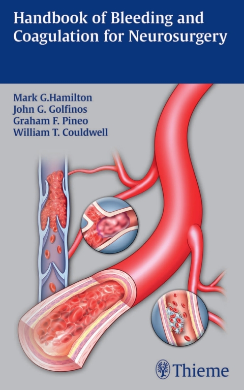Cover image for book Handbook of Bleeding and Coagulation for Neurosurgery