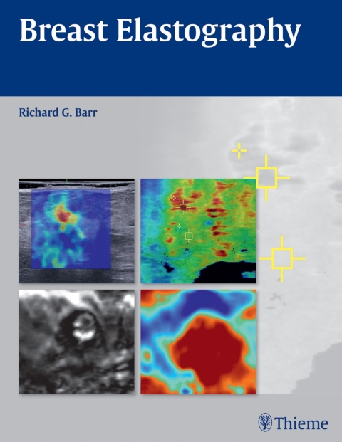 Cover image for book Breast Elastography