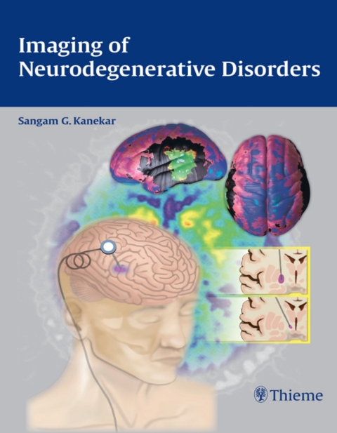 Cover image for book Imaging of Neurodegenerative Disorders