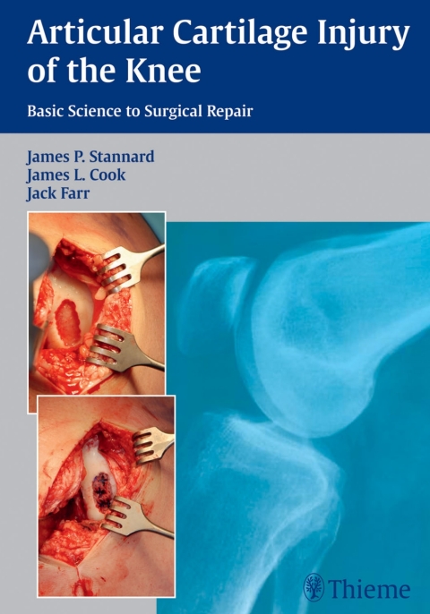 Cover image for book Articular Cartilage Injury of the Knee: Basic Science to Surgical Repair
