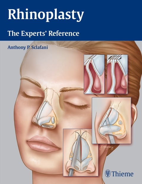 Cover image for book Rhinoplasty