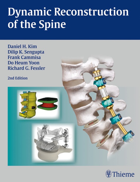 Cover image for book Dynamic Reconstruction of the Spine