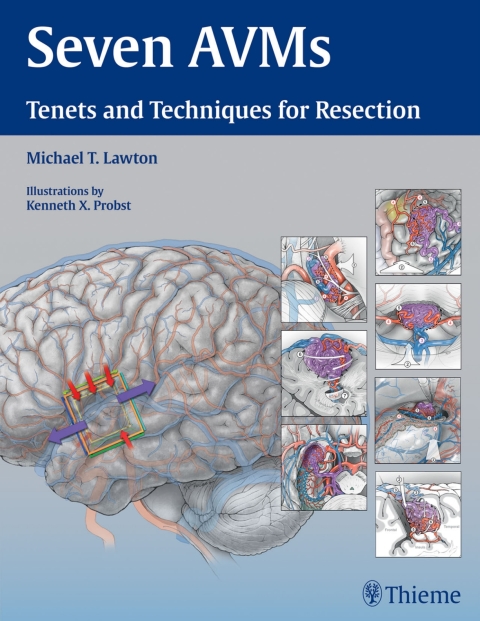 Cover image for book Seven AVMs