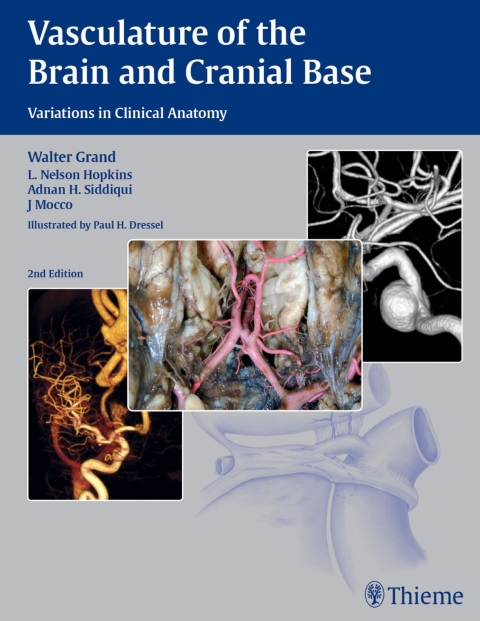 Cover image for book Vasculature of the Brain and Cranial Base
