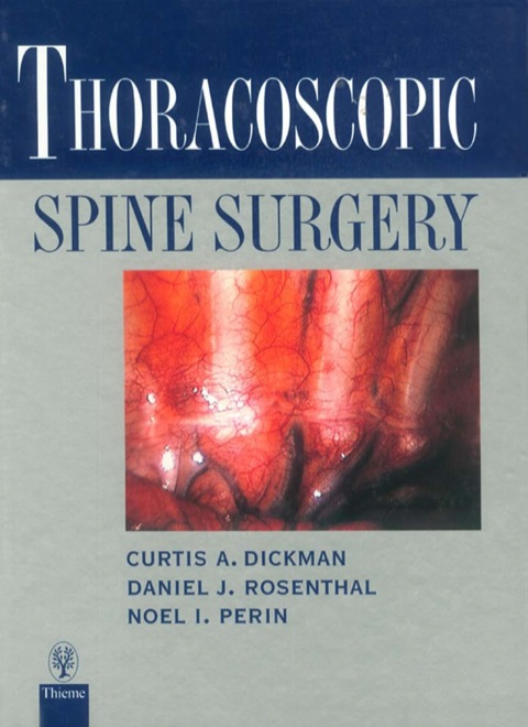 Cover image for book Thoracoscopic Spine Surgery