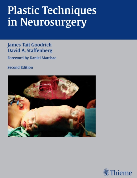 Plastic Techniques in Neurosurgery 