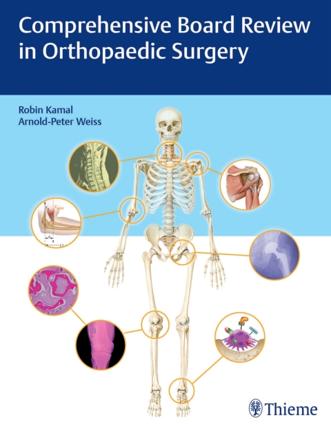 Cover image for book Comprehensive Board Review in Orthopaedic Surgery