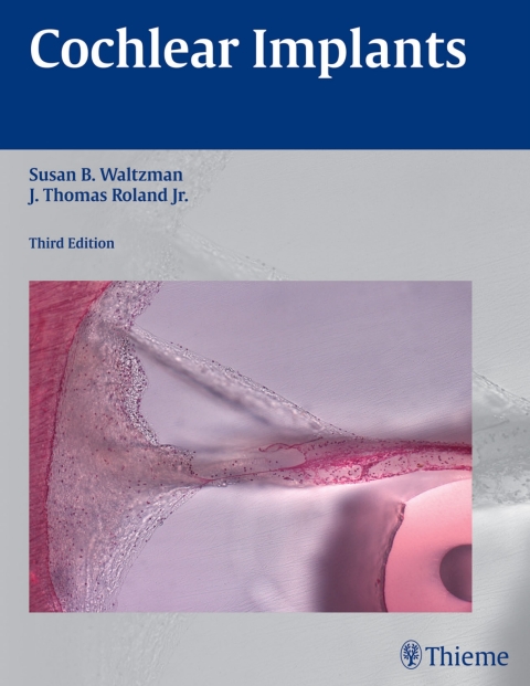 Cover image for book Cochlear Implants