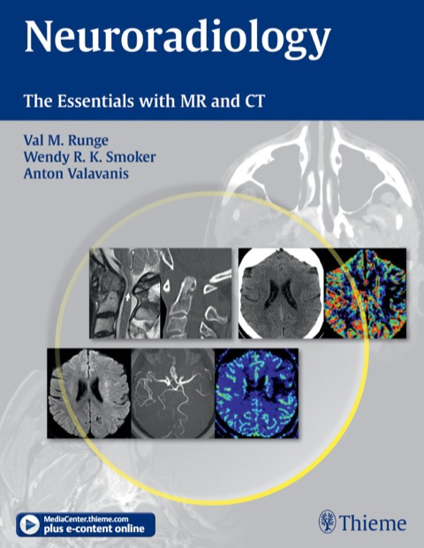 Cover image for book Neuroradiology