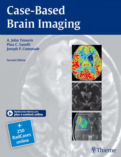 Cover image for book Case-Based Brain Imaging