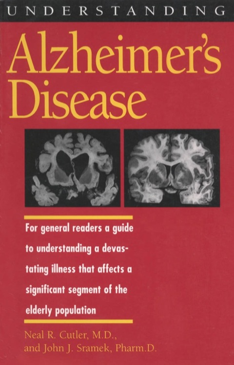 Cover image for book Understanding Alzheimer's Disease