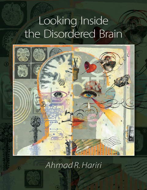 Cover image for book Looking Inside the Disordered Brain