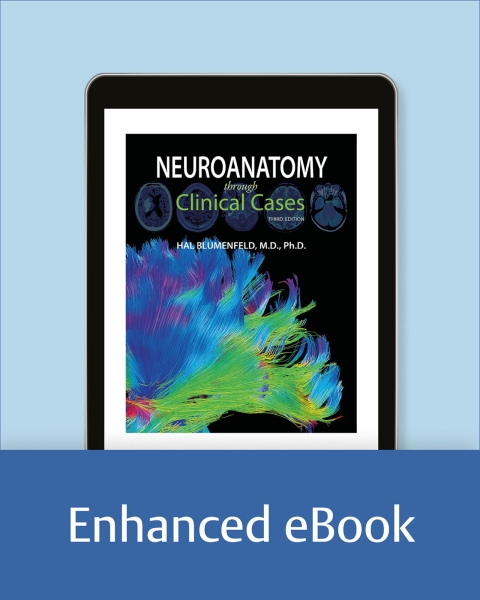 Neuroanatomy Through Clinical Cases
