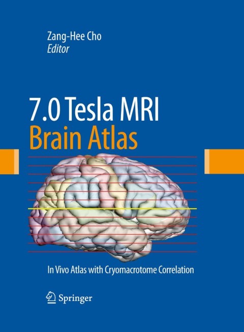 Cover image for book 7.0 Tesla MRI Brain Atlas