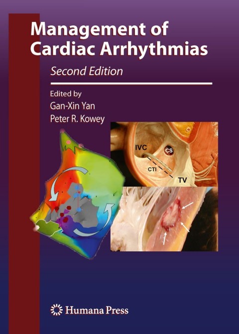 Cover image for book Management of Cardiac Arrhythmias