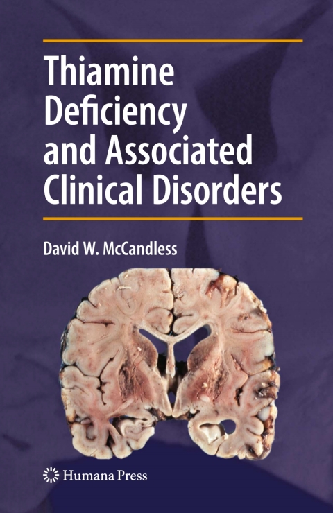 Cover image for book Thiamine Deficiency and Associated Clinical Disorders