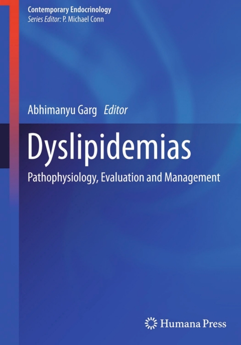 Cover image for book Dyslipidemias