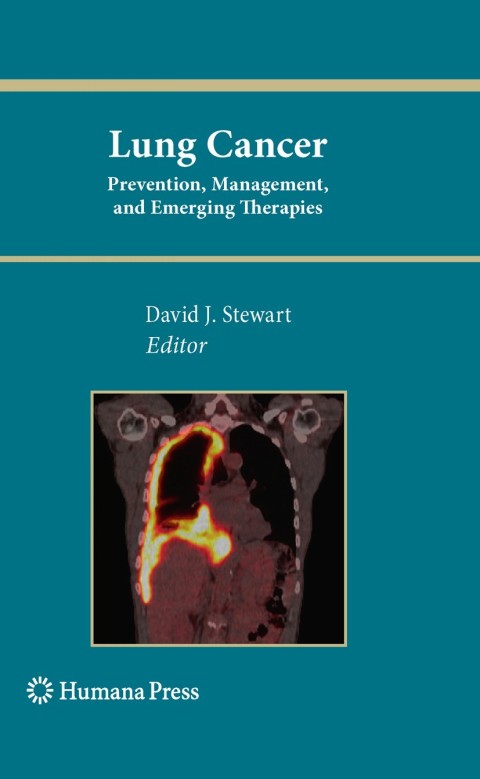 Cover image for book Lung Cancer: